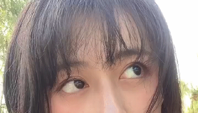 重庆超雅超声波双眼皮手术让你成为心目中的女神676