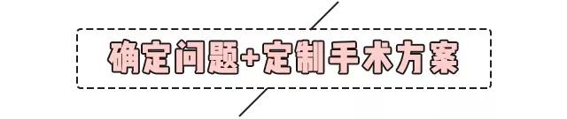 重庆超雅超声波双眼皮手术让你成为心目中的女神676