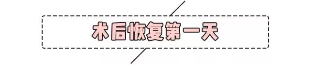 重庆超雅超声波双眼皮手术让你成为心目中的女神676