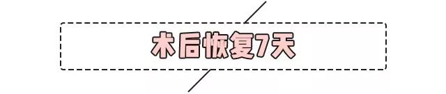 重庆超雅超声波双眼皮手术让你成为心目中的女神676
