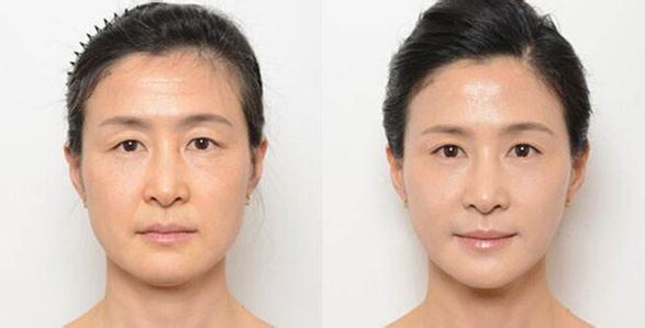 重庆超雅超级微拉美给你想要得青春 重庆超雅超级微拉美给你想要得青春