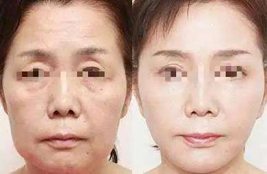重庆超雅超级微拉美给你想要得青春 重庆超雅超级微拉美给你想要得青春