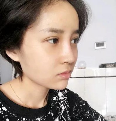 重庆超雅超声波双眼皮,让我变的更美161 重庆超雅超声波双眼皮,让我变的更美161