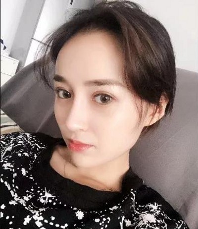 重庆超雅超声波双眼皮,让我变的更美161 重庆超雅超声波双眼皮,让我变的更美161