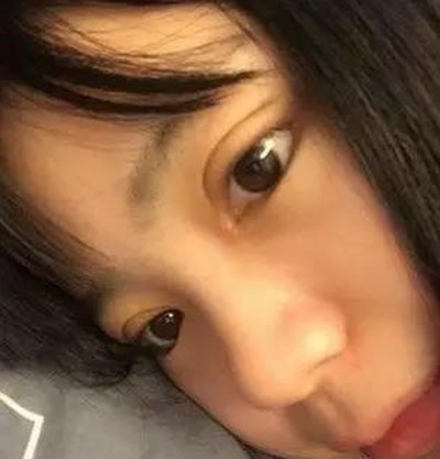 重庆超雅超 声 波双眼 皮 ,值得信赖 重庆超雅超 声 波双眼 皮 ,值得信赖