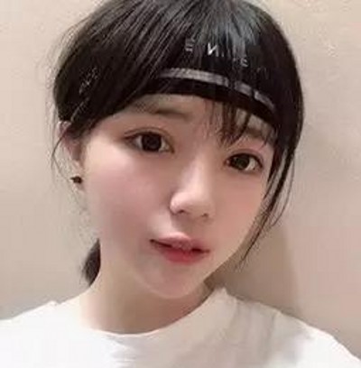重庆超雅超 声 波双眼 皮 ,值得信赖 重庆超雅超 声 波双眼 皮 ,值得信赖