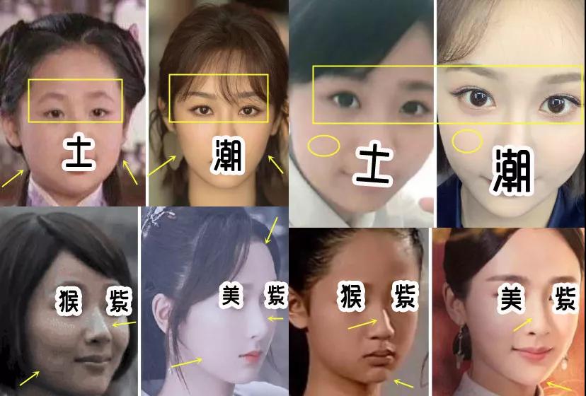 重庆超雅双眼皮手术经典案例来袭264 重庆超雅双眼皮手术经典案例来袭264