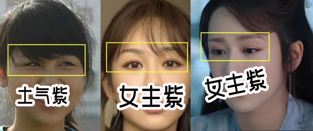 重庆超雅双眼皮手术经典案例来袭264 重庆超雅双眼皮手术经典案例来袭264