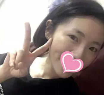 重庆超雅双眼皮手术经典案例来袭264 重庆超雅双眼皮手术经典案例来袭264