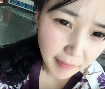 重庆双眼皮手术哪里做得好?重庆超雅!138 重庆双眼皮手术哪里做得好?重庆超雅!138