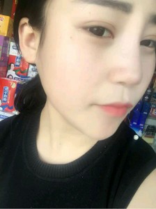 重庆双眼皮手术哪里做得好?重庆超雅!138 重庆双眼皮手术哪里做得好?重庆超雅!138