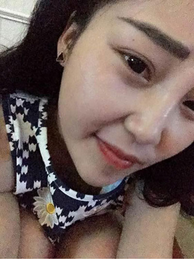 重庆双眼皮手术哪里做得好?重庆超雅!138 重庆双眼皮手术哪里做得好?重庆超雅!138