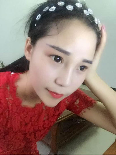 重庆双眼皮手术哪里做得好?重庆超雅!138 重庆双眼皮手术哪里做得好?重庆超雅!138