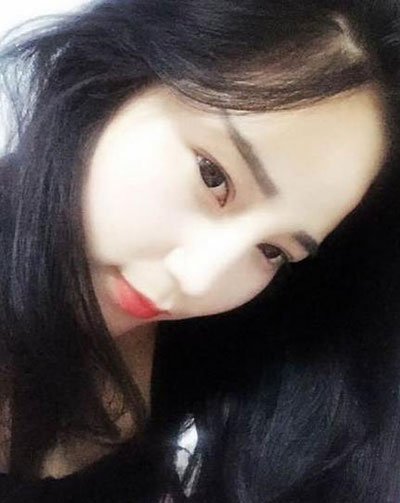 重庆双眼皮手术哪里做得好?重庆超雅!138 重庆双眼皮手术哪里做得好?重庆超雅!138