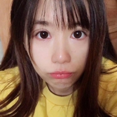 重庆超雅超声波去眼袋，没有了眼袋化妆得心应手了808