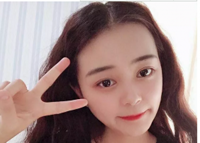 “过来人”推荐双眼 皮手术——超 声 波双眼 皮！