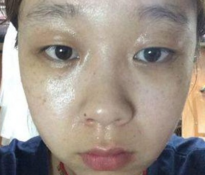 “梁氏双眼皮公式”做出来的双眼皮就是好看!533 “梁氏双眼皮公式”做出来的双眼皮就是好看!533