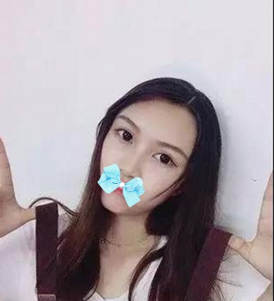 又快过年le，爱美得你想做超 声 波双眼 皮抓紧时间啦！