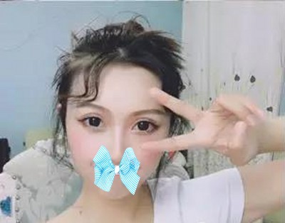 又快过年le，爱美得你想做超 声 波双眼 皮抓紧时间啦！