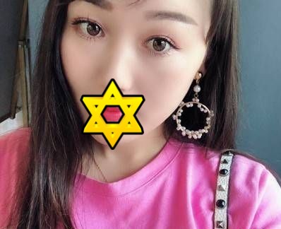 超 声 波双眼 皮让wǒhold住各种风格 超 声 波双眼 皮让wǒhold住各种风格