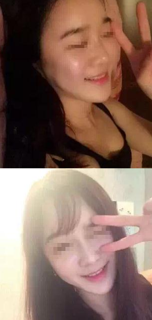 重庆超雅玻尿酸填充泪沟,变成靓丽的美眉539 重庆超雅玻尿酸填充泪沟,变成靓丽的美眉539