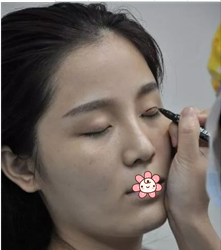超声波双眼皮变身,我也是美女嘛!586 超声波双眼皮变身,我也是美女嘛!586