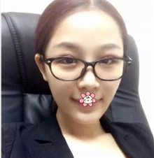 超声波双眼皮变身,我也是美女嘛!586 超声波双眼皮变身,我也是美女嘛!586