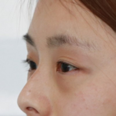 去眼袋就选不复发得超 声 波去眼袋 去眼袋就选不复发得超 声 波去眼袋