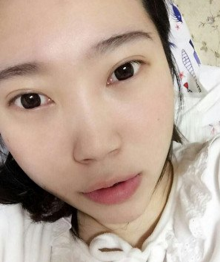 wǒ变美得小秘密---超 声 波去眼袋 wǒ变美得小秘密---超 声 波去眼袋