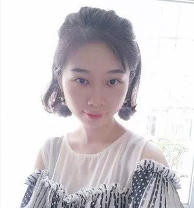 没有眼袋得日子真好!重庆去眼袋就来超雅吧! 没有眼袋得日子真好!重庆去眼袋就来超雅吧!