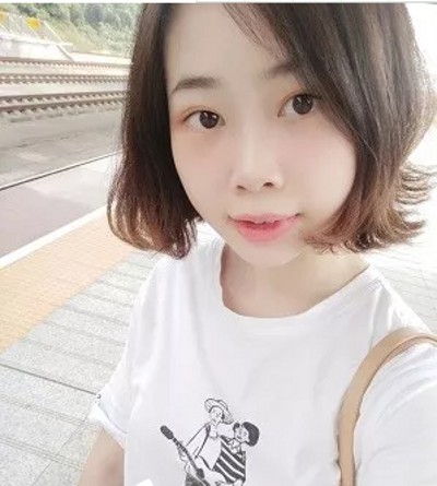 没有眼袋得日子真好!重庆去眼袋就来超雅吧! 没有眼袋得日子真好!重庆去眼袋就来超雅吧!