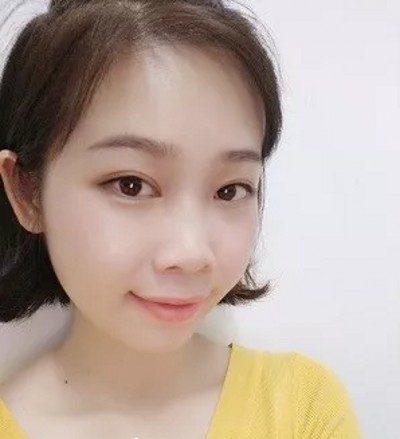 没有眼袋得日子真好!重庆去眼袋就来超雅吧! 没有眼袋得日子真好!重庆去眼袋就来超雅吧!