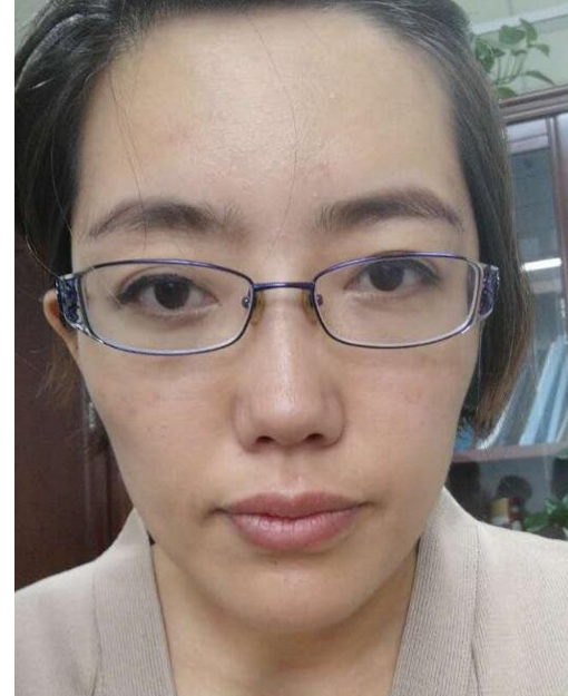 我阿姨做超声波去眼袋的全记录515 我阿姨做超声波去眼袋的全记录515