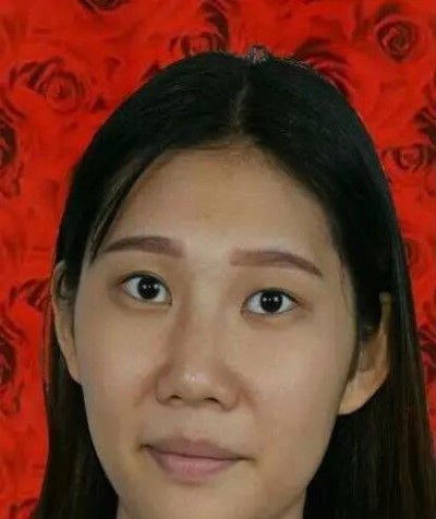 美美的眼睛美美的心情超声波双眼皮126 美美的眼睛美美的心情超声波双眼皮126