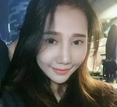 美美的眼睛美美的心情超声波双眼皮126 美美的眼睛美美的心情超声波双眼皮126