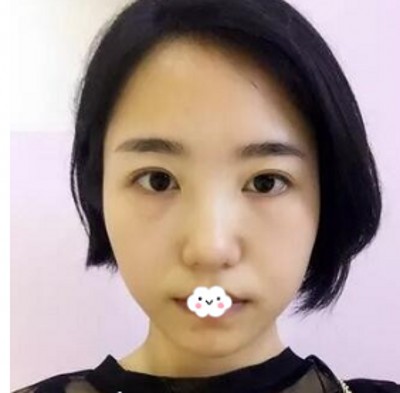 去掉眼袋,就是看着年轻、漂亮、有气质!797 去掉眼袋,就是看着年轻、漂亮、有气质!797