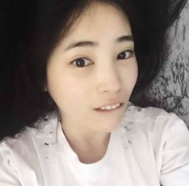 谢谢超声波去眼袋去掉我的眼袋,开始新恋情483 谢谢超声波去眼袋去掉我的眼袋,开始新恋情483