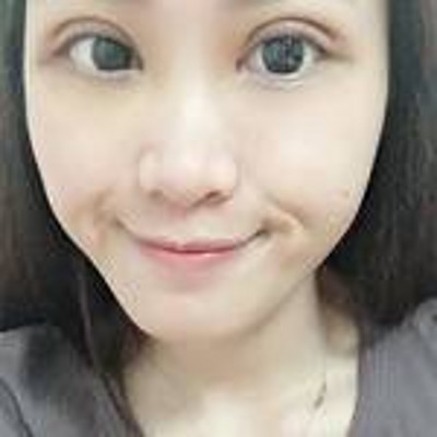 超声波双眼皮让我有了一双美丽的大眼睛337 超声波双眼皮让我有了一双美丽的大眼睛337