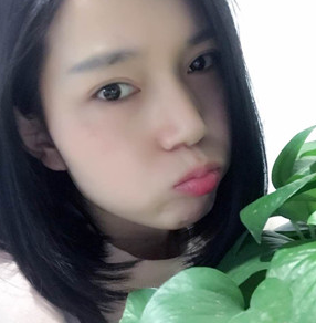 重庆超雅去眼袋手术,让你告别美颜相机!!042 重庆超雅去眼袋手术,让你告别美颜相机!!042