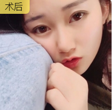眼袋