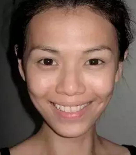 重庆哪家整形单位够火爆?重庆超雅!601 重庆哪家整形单位够火爆?重庆超雅!601
