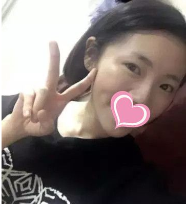 超 声 波双眼 皮不shì美，shì很美！