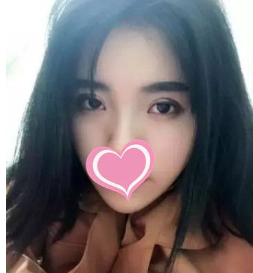超 声 波双眼 皮不shì美，shì很美！