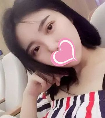 超 声 波双眼 皮不shì美，shì很美！