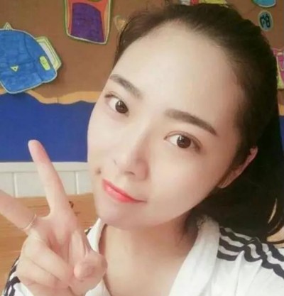 梁医生为我制定了与眼型相对应的超声波双眼皮826 梁医生为我制定了与眼型相对应的超声波双眼皮826