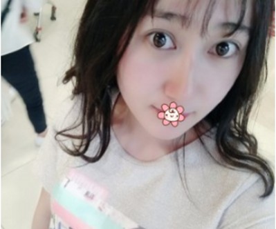 想要天然得双眼 皮就选超 声 波双眼 皮真得没错！