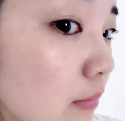 超 声 波双眼 皮,美丽自己从现在开始 超 声 波双眼 皮,美丽自己从现在开始