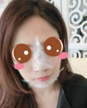 重庆超雅下巴延长术不动刀得哦！