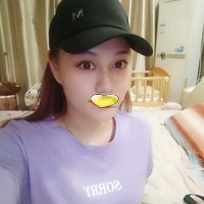 超 声 波为眼袋效果怎么样?就俩字——完美! 超 声 波为眼袋效果怎么样?就俩字——完美!
