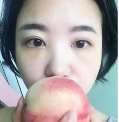 时间不等人,去眼袋要趁早! 时间不等人,去眼袋要趁早!